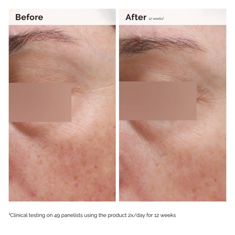 THE ORDINARY Niacinamide 5% Face & Body Emulsion 100 ml