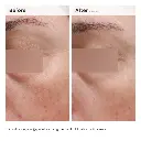 THE ORDINARY Niacinamide 5% Face & Body Emulsion 100 ml