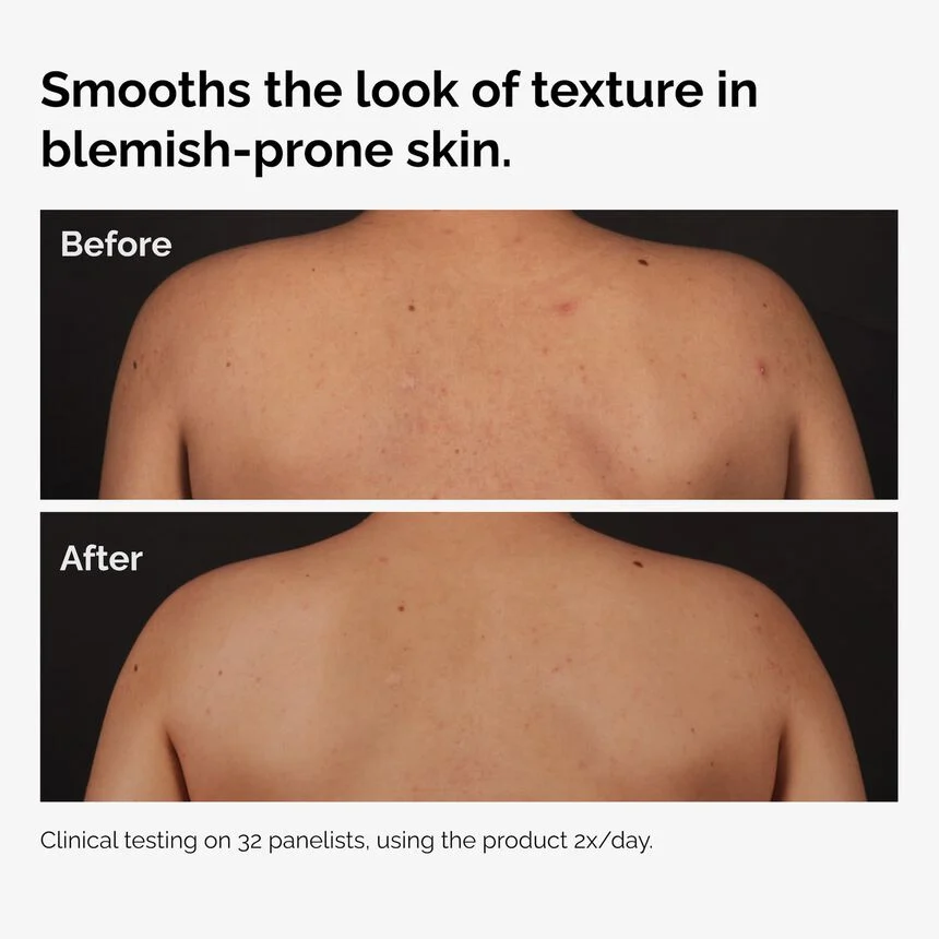 THE ORDINARY Salicylic Acid 0.5% Body Serum 240 ml 