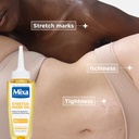 MIXA ANTI-STRETCH MARK OIL 100 ML