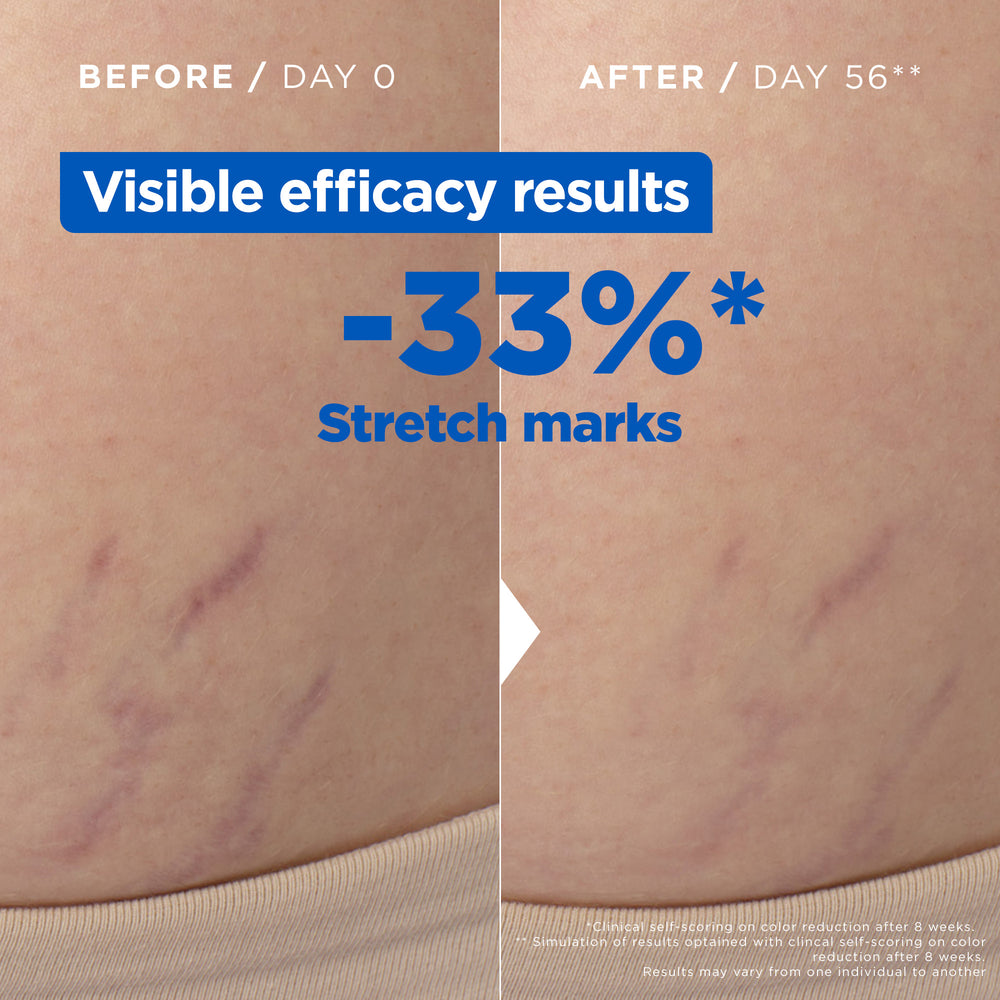 MIXA ANTI-STRETCH MARK OIL 100 ML