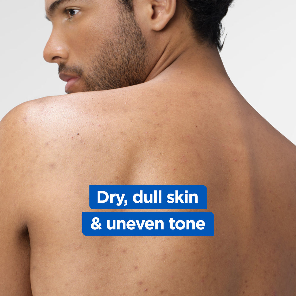 MIXA NIACINAMIDE LOTION 