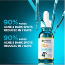 GARNIER SN ANTI ACNE BOOSTER SERUM 30 ML 
